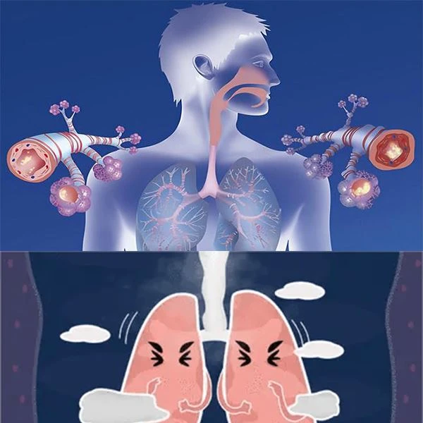 Promethazine can deal with cough caused by irritation of trachea. Promethazine can deal with cough caused by irritation of trachea.